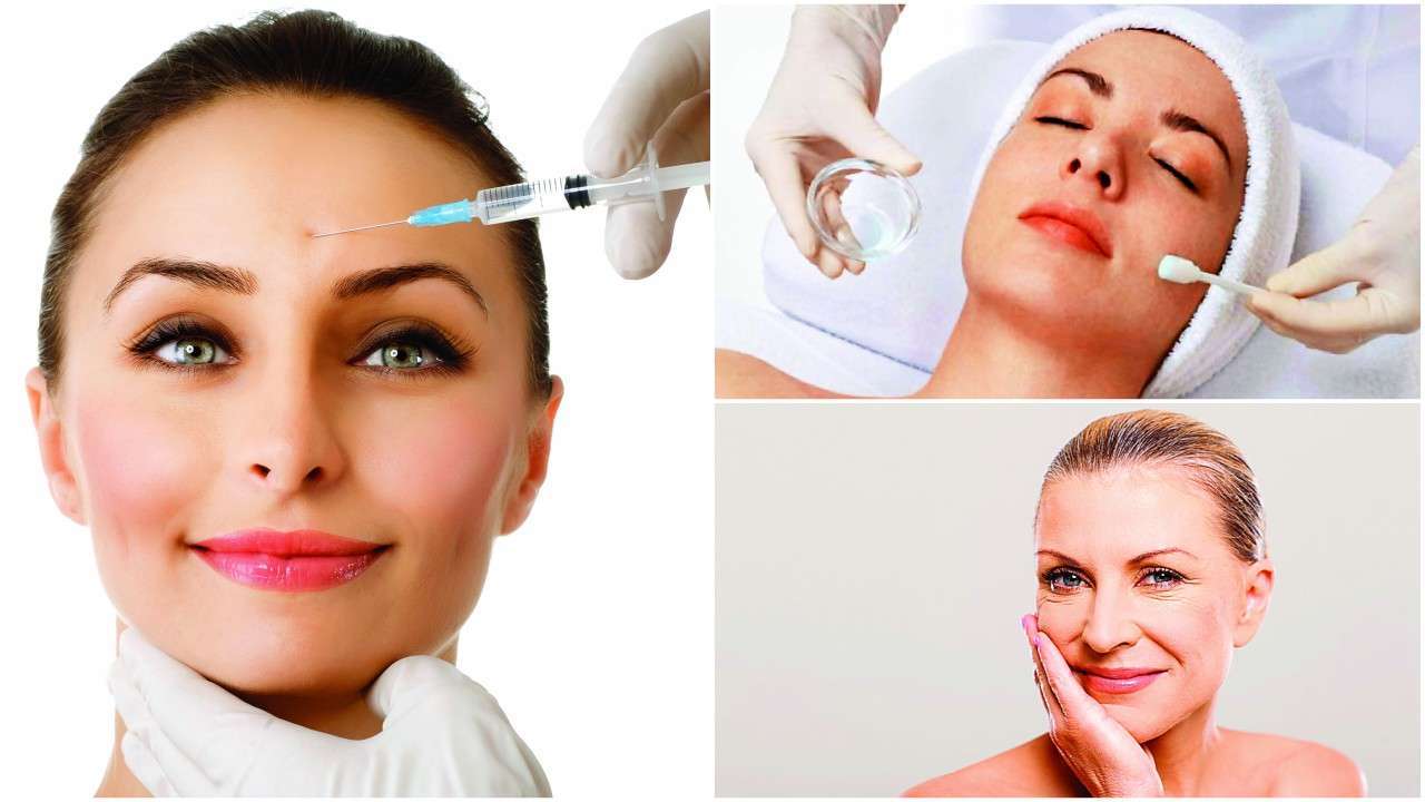 Cosmetic precedure for facelift