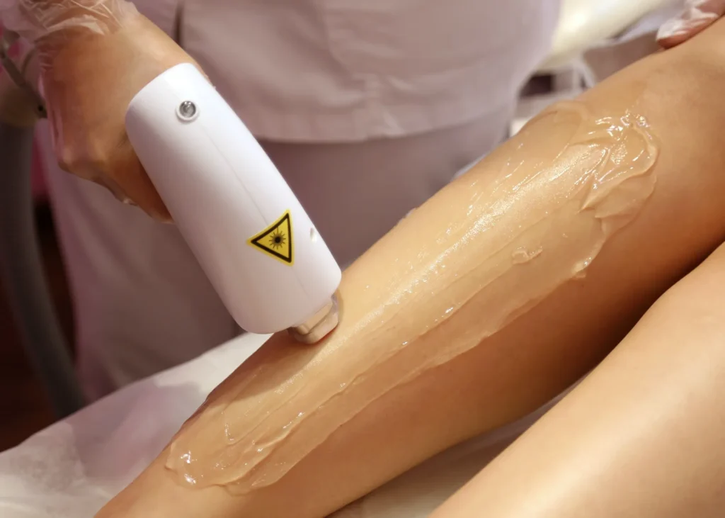 Electrolysis Hair Removal