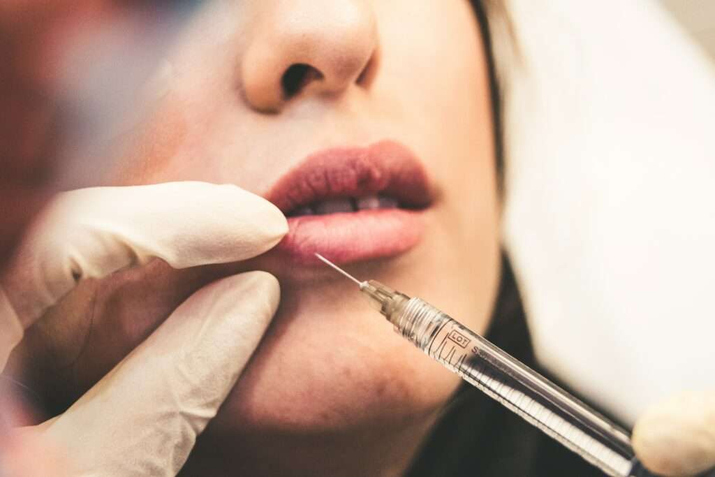 Lip Filler Treatment : Meaning, Types, Benefits, and Side effects