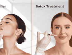 Difference Between Botox and Fillers