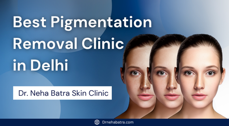 Best Pigmentation Removal Clinic in Delhi | Dr. Neha Batra Skin Clinic