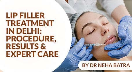 Lip Filler Treatment in Delhi: Procedure, Results & Expert Care