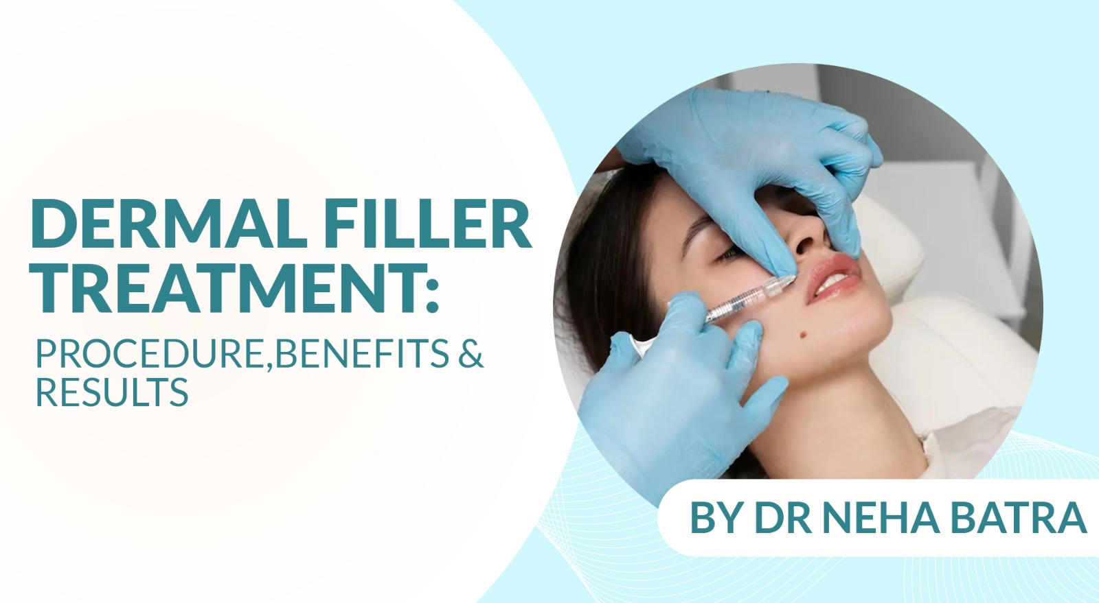 Dermal Filler Treatment