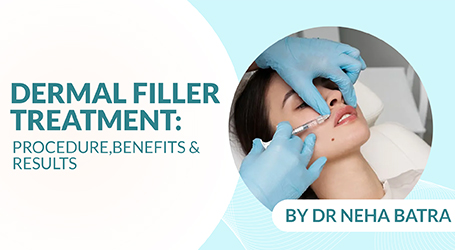 Dermal Filler Treatment by Dr Neha Batra: Procedure, Benefits & Results
